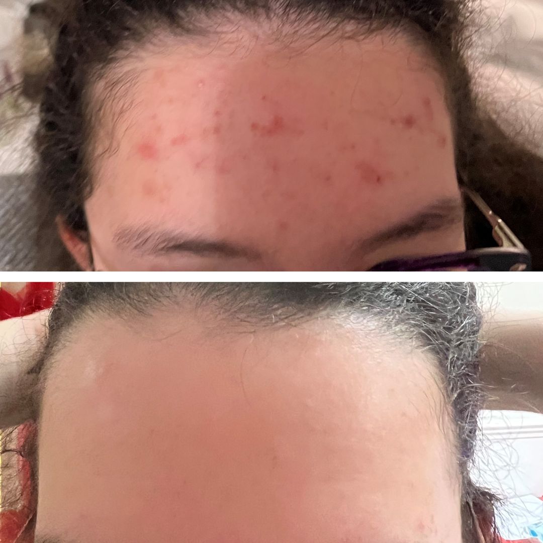 Skin:Genius has single handedly provided the best skincare solution!