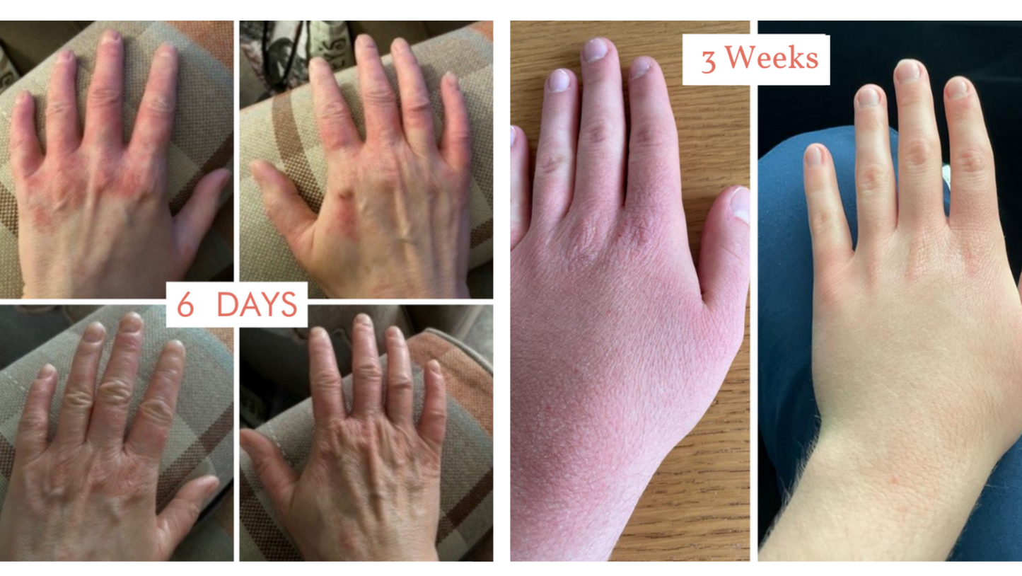 Itchy, tight skin driving you crazy?