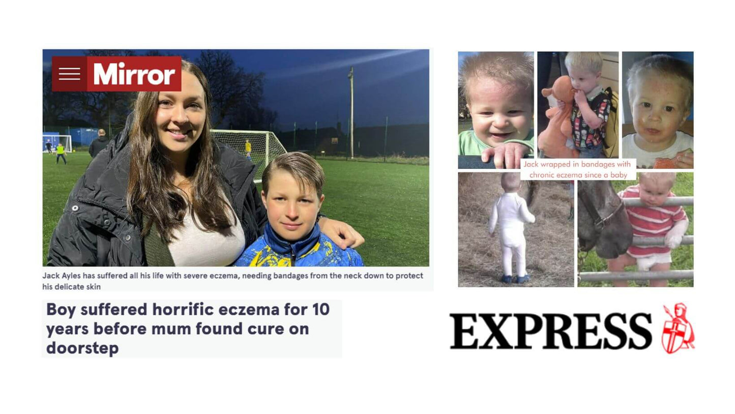 Skin:Genius ended 10-year search for eczema solution