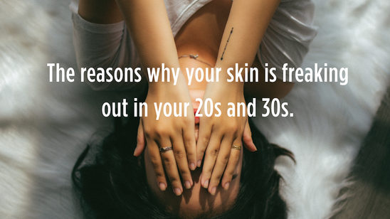 Adult Acne: The Reasons Why Your Skin Is Freaking Out In Your 20s and 30s