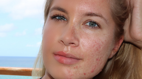 Find Your Skin Confident Moment