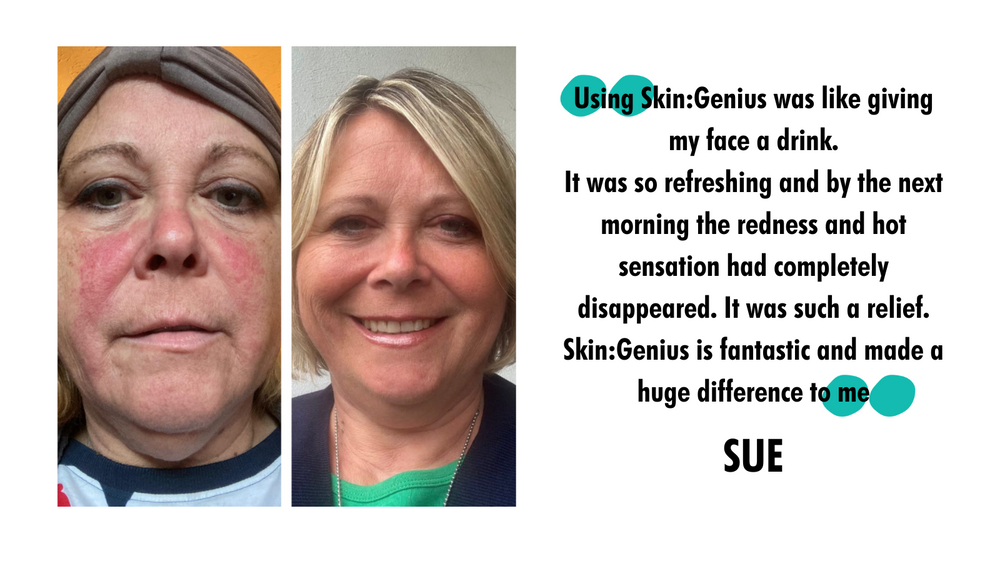 How to calm your skin when you have "chemo flush"