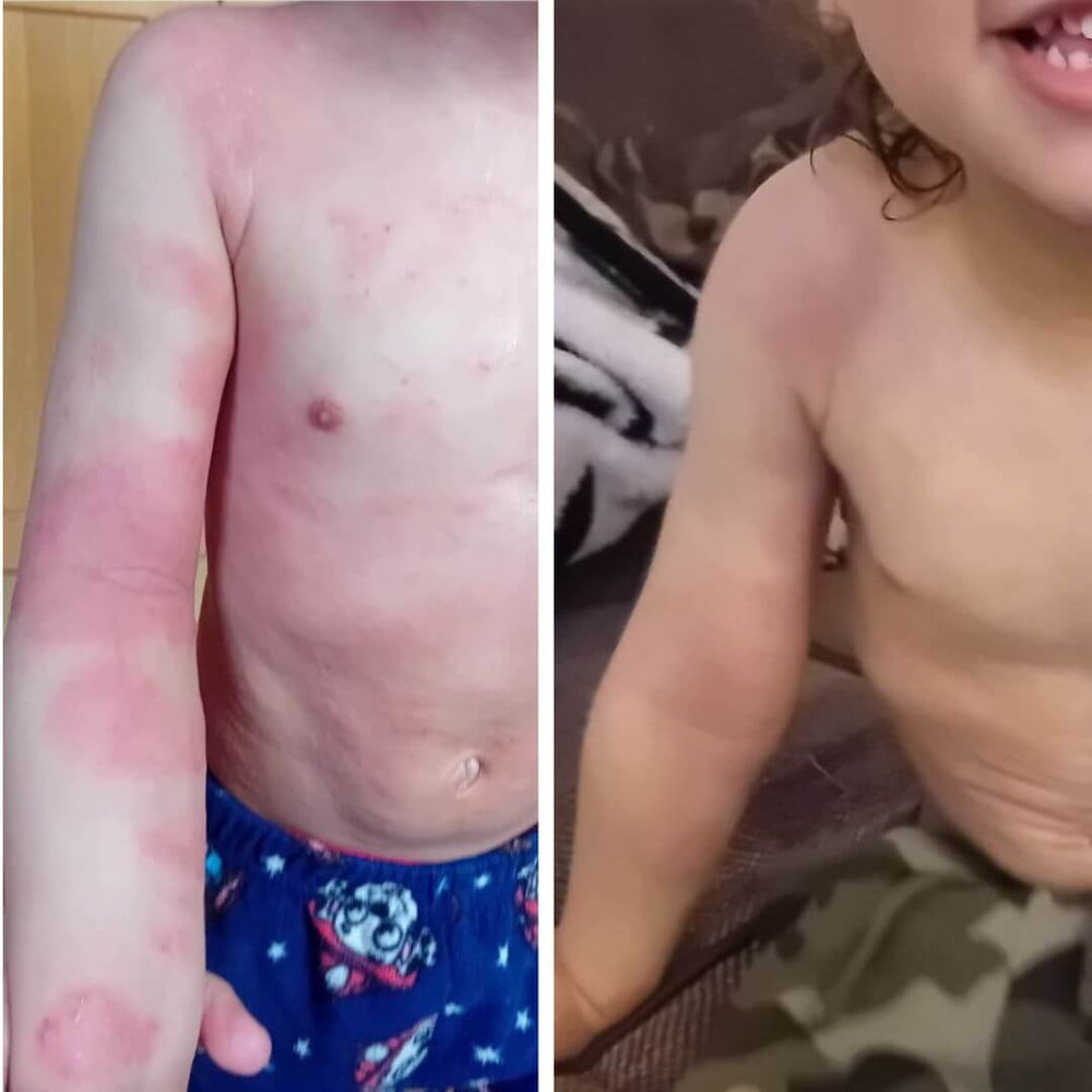 Save Our Skin Duo